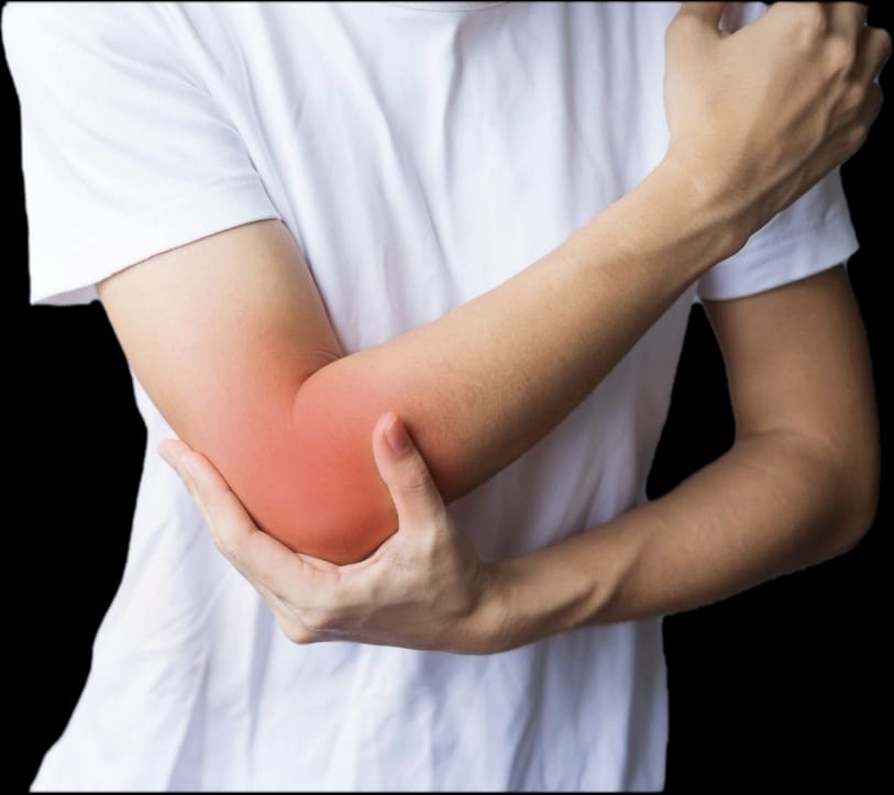 Imagen ilustrativa de atrapamiento cubital